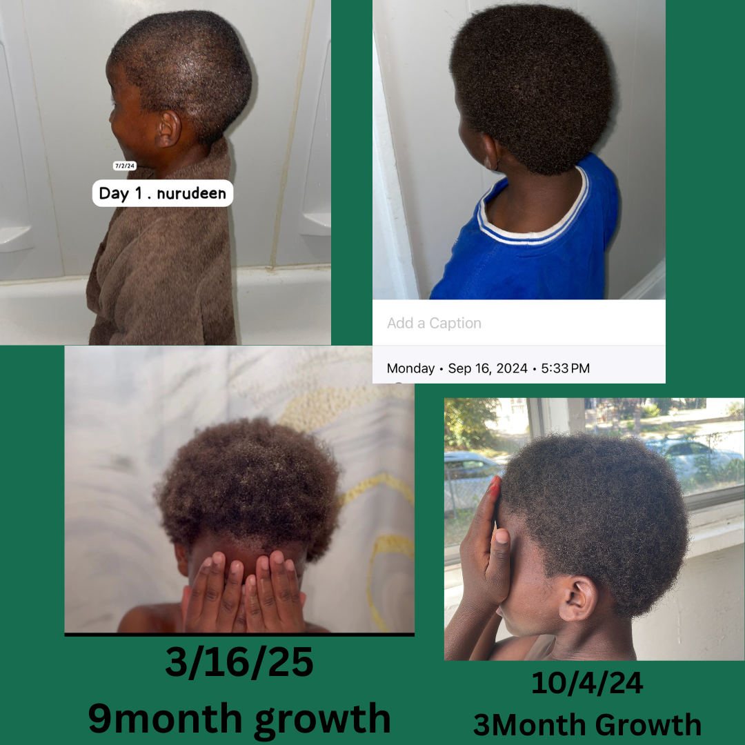 Ultimate Growth Elixir – Ayurvedic Hair Growth Oil for Fast Regrowth, Scalp Nourishment & Stronger Hair | Natural Herbal Formula (4 oz)