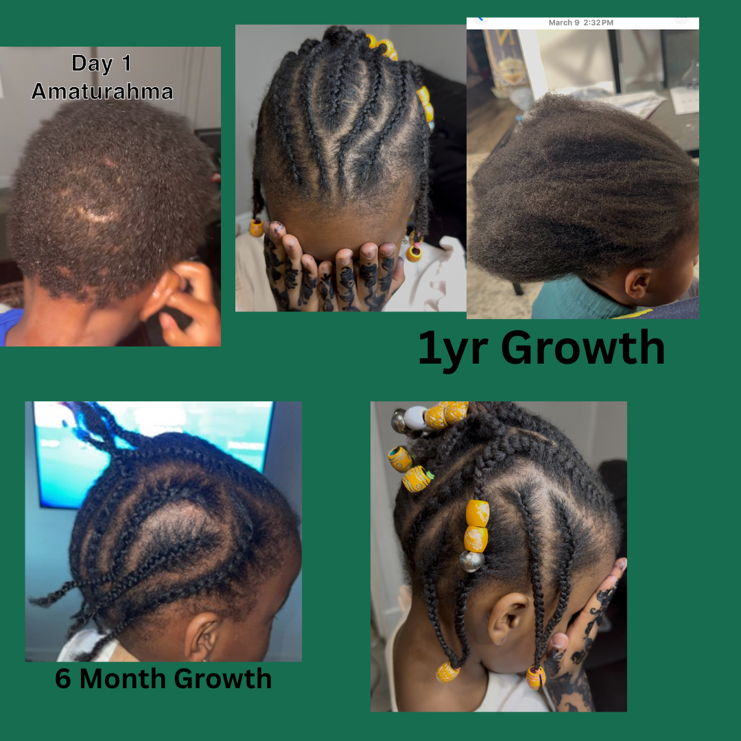 Ultimate Growth Elixir – Ayurvedic Hair Growth Oil for Fast Regrowth, Scalp Nourishment & Stronger Hair | Natural Herbal Formula (4 oz)